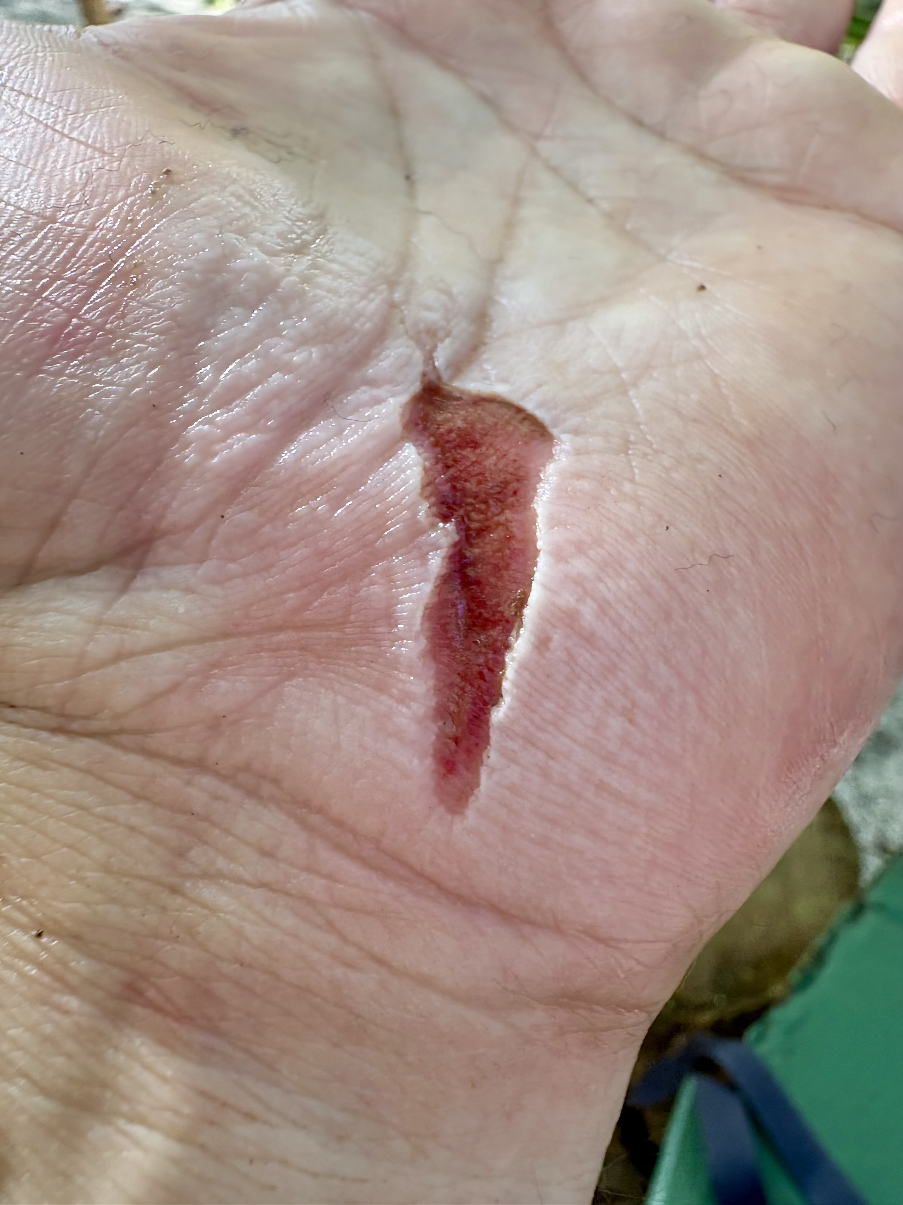 Entaille main gauche